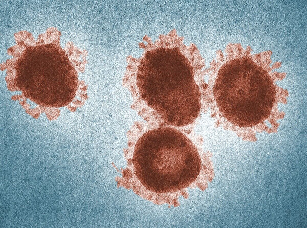 Coronavirus Genetic Markers: An Overview of Their Role in Diagnosis and Treatment.